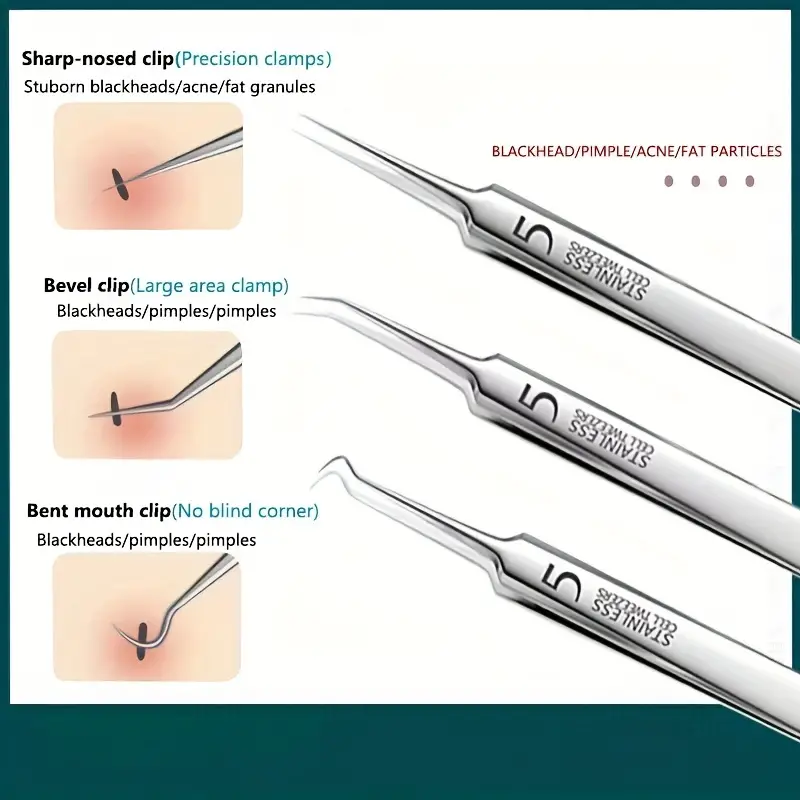 طقم أدوات إزالة حب الشباب 3-8  - مراجعة Luxury Skincare Acne وسعره