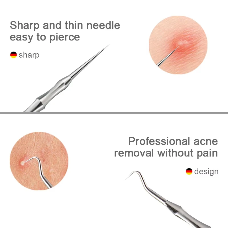 مجموعة أدوات إزالة الرؤوس السو - مراجعة Luxury Skincare Acne وسعره